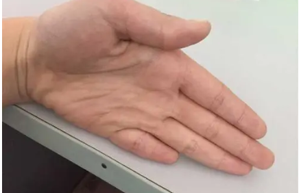 手指最后一根叫什么(一根手指是半码还是一码)-第1张图片-百花生活百科知识分享 手指最后一根叫什么(一根手指是半码还是一码)-第1张图片-百花生活百科知识分享