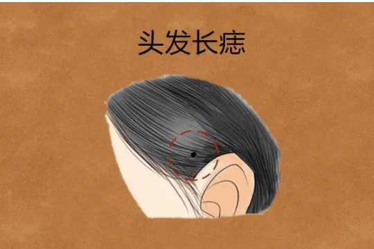 面部痣好坏一览表 面部哪里长痣好?女人面部最好的痣 面部痣好坏一览表?-第3张图片-百花生活百科知识分享 面部痣好坏一览表 面部哪里长痣好?女人面部最好的痣 面部痣好坏一览表?-第3张图片-百花生活百科知识分享