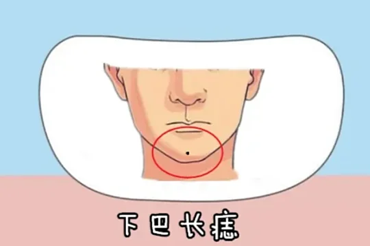 面部痣好坏一览表 面部哪里长痣好?女人面部最好的痣 面部痣好坏一览表?-第10张图片-百花生活百科知识分享 面部痣好坏一览表 面部哪里长痣好?女人面部最好的痣 面部痣好坏一览表?-第10张图片-百花生活百科知识分享