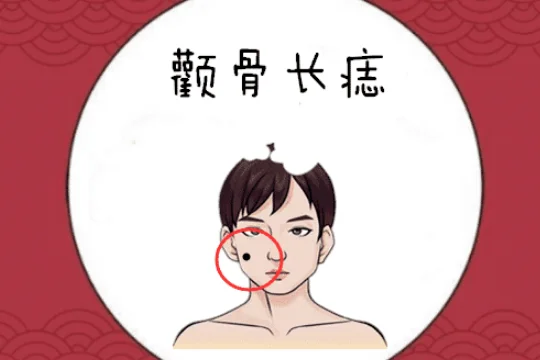 面部痣好坏一览表 面部哪里长痣好?女人面部最好的痣 面部痣好坏一览表?-第8张图片-百花生活百科知识分享 面部痣好坏一览表 面部哪里长痣好?女人面部最好的痣 面部痣好坏一览表?-第8张图片-百花生活百科知识分享