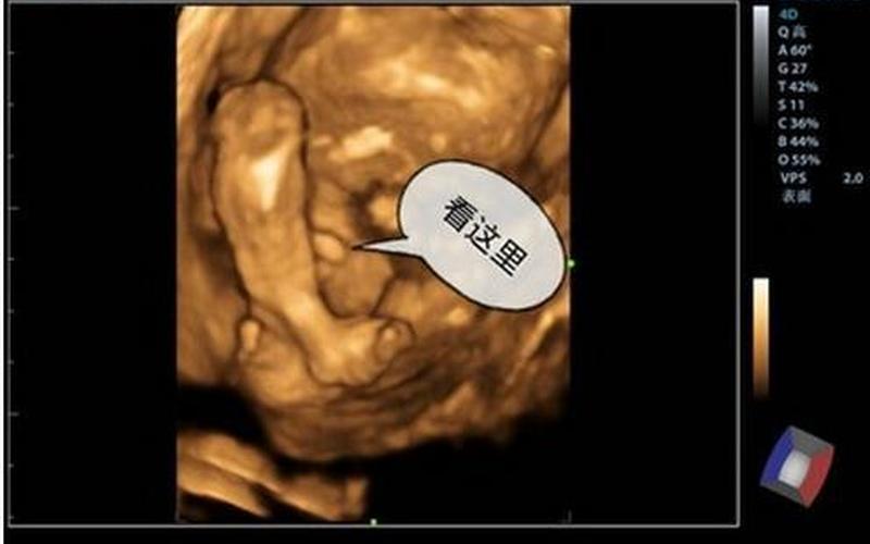 五个月男胎儿彩超图-第1张图片-百花生活百科知识分享
