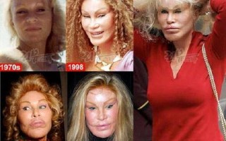 jocelyn wildenstein