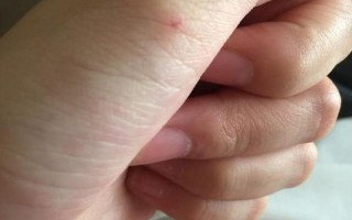 10种图片猫抓破皮不需要打针