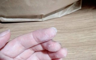 502胶水粘在手上怎么去除